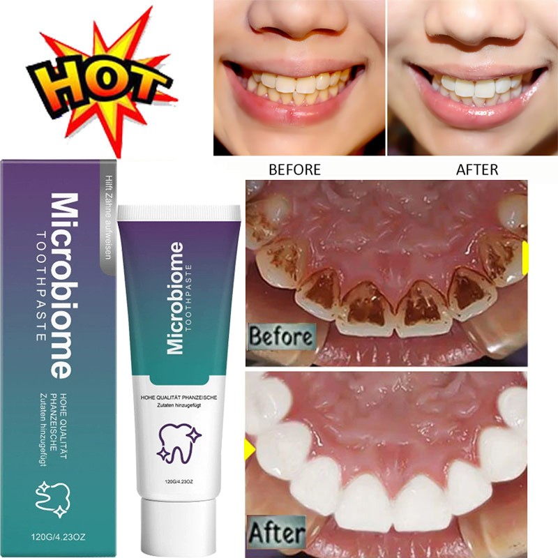 Microbiome Mint Flavor Gum Toothpaste Cleaning Toothpaste Sensitive Teeth 120g