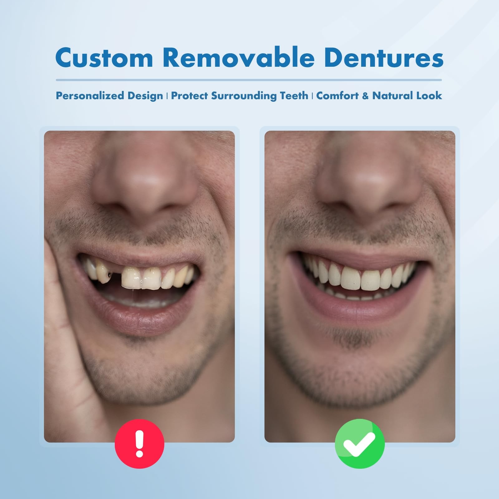Custom Removable Dentures – Personalized Partial Denture Set 3 Teeth, White