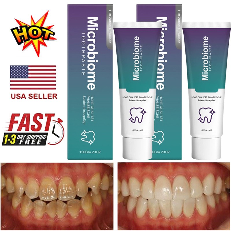 Microbiome Mint Flavor Gum Toothpaste Cleaning Toothpaste Sensitive Teeth 120g