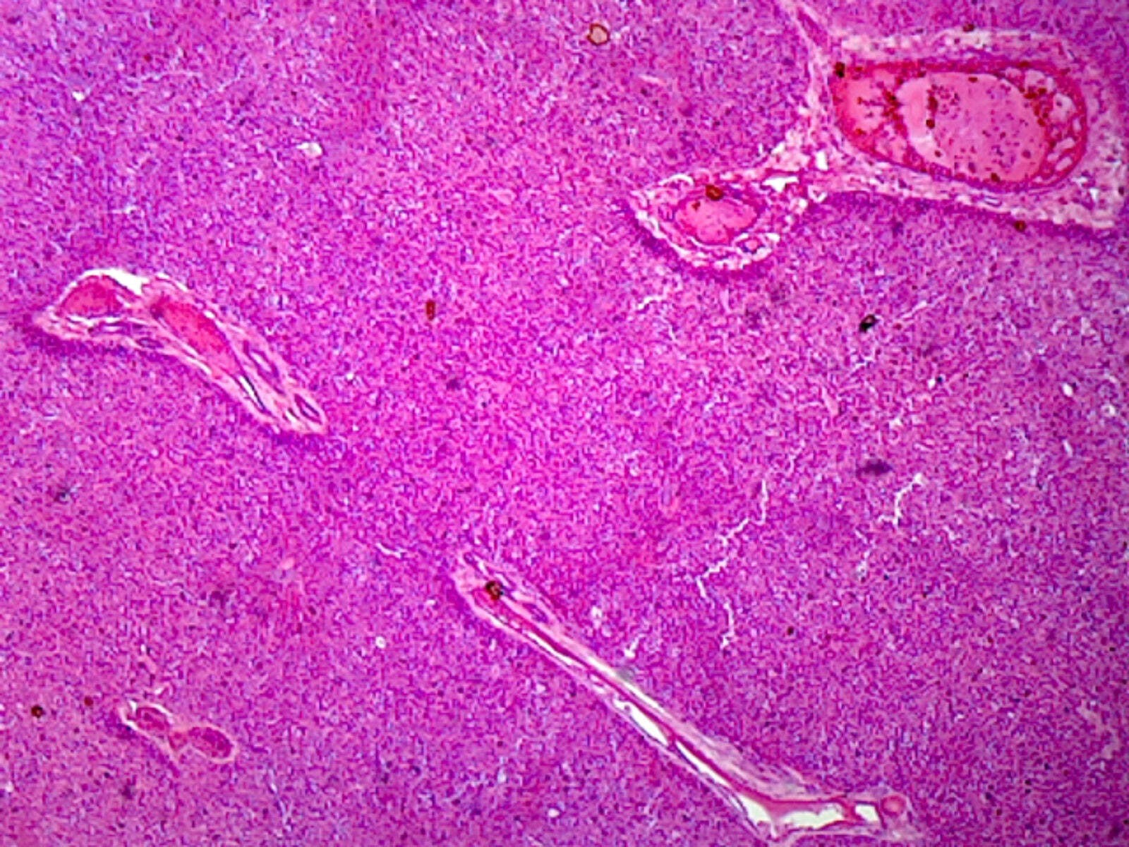 Liver, Mammalian; Showing Hepatic Cells; Section; H&E Stain