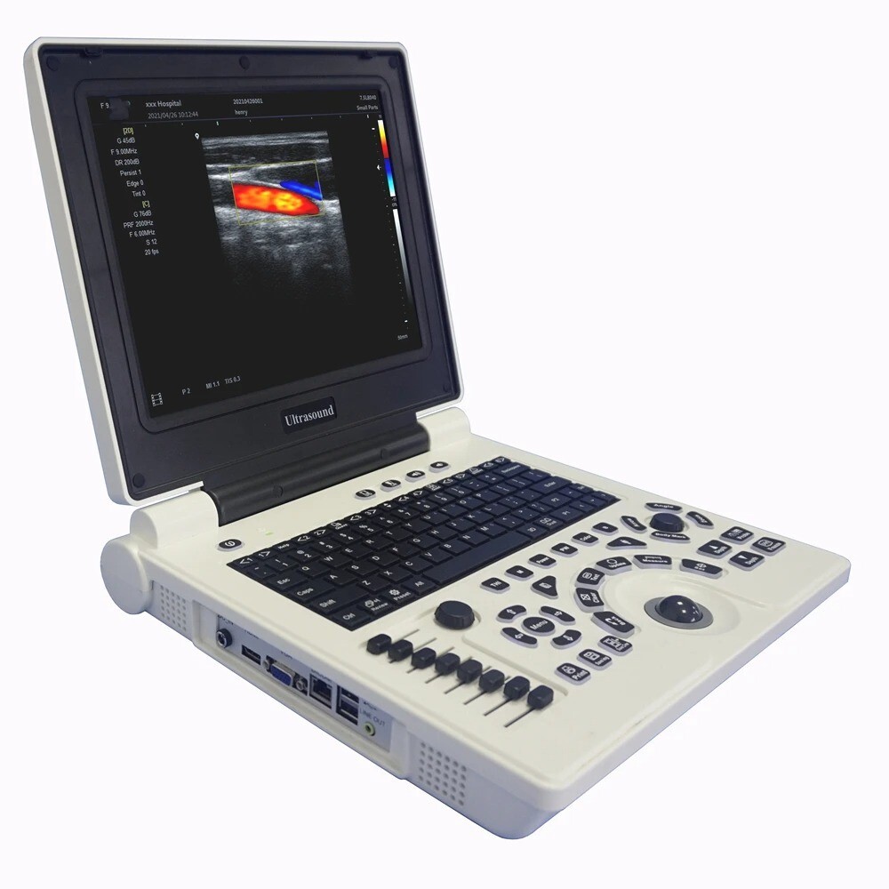 Portable 12" Laptop Ultrasound Color Doppler w/Convex Linear Probes